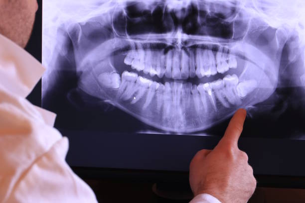 Best Emergency Gum Treatment in Marshall, MI